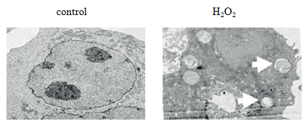 5bffb0e00b940.png image.png