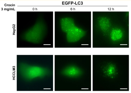 5bffb19a538f6.png image.png