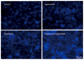 5bffb1f20239b.png image.png