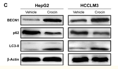 5bffb4429de7f.png image.png